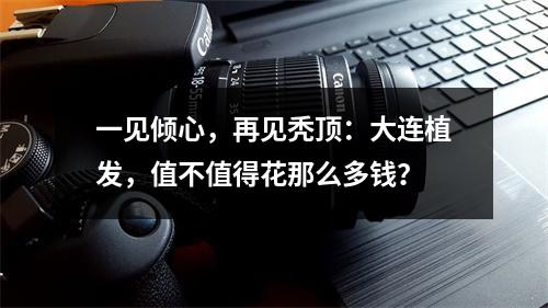 一见倾心，再见秃顶：大连植发，值不值得花那么多钱？