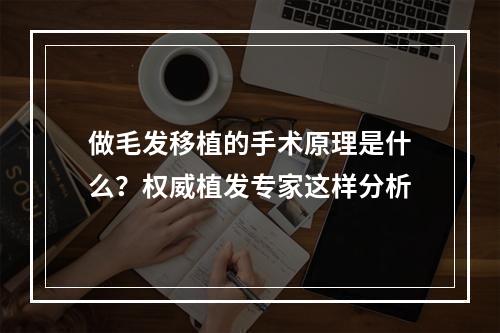 做毛发移植的手术原理是什么？权威植发专家这样分析