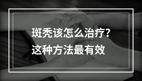 斑秃该怎么治疗？这种方法最有效