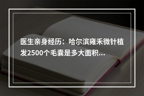 医生亲身经历：哈尔滨雍禾微针植发2500个毛囊是多大面积？