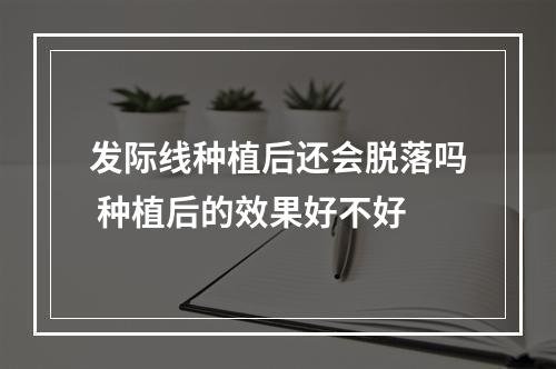 发际线种植后还会脱落吗 种植后的效果好不好