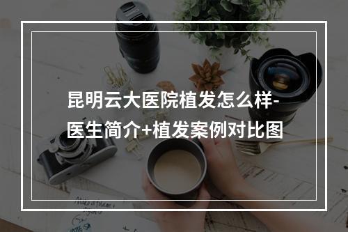 昆明云大医院植发怎么样-医生简介+植发案例对比图