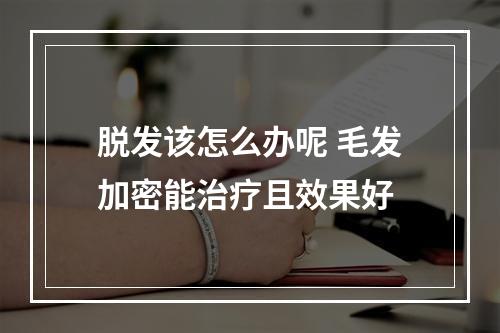 脱发该怎么办呢 毛发加密能治疗且效果好