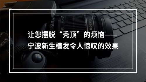 让您摆脱“秃顶”的烦恼——宁波新生植发令人惊叹的效果