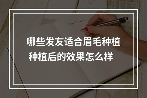 哪些发友适合眉毛种植 种植后的效果怎么样