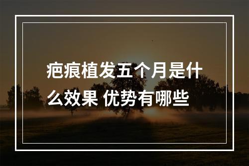 疤痕植发五个月是什么效果 优势有哪些