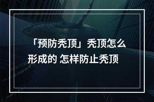 「预防秃顶」秃顶怎么形成的 怎样防止秃顶