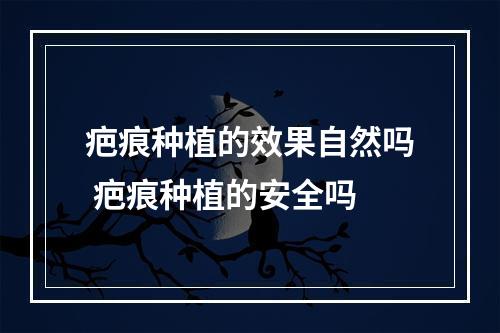 疤痕种植的效果自然吗 疤痕种植的安全吗