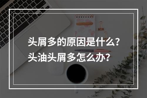 头屑多的原因是什么？头油头屑多怎么办？