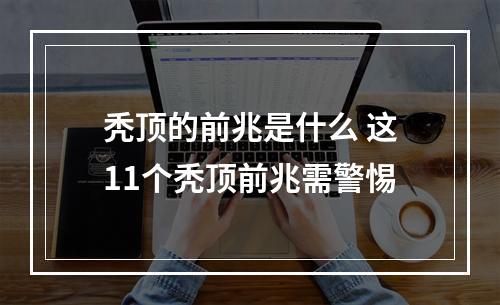 秃顶的前兆是什么 这11个秃顶前兆需警惕