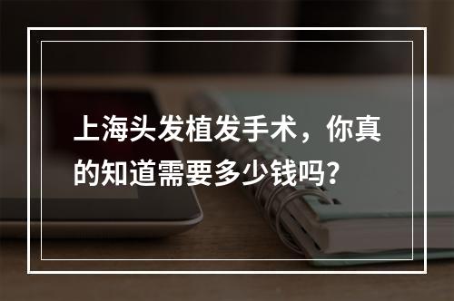 上海头发植发手术，你真的知道需要多少钱吗？