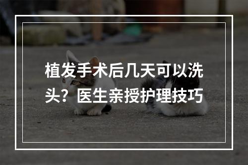 植发手术后几天可以洗头？医生亲授护理技巧