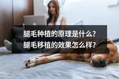 腿毛种植的原理是什么？腿毛移植的效果怎么样？