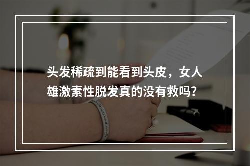 头发稀疏到能看到头皮，女人雄激素性脱发真的没有救吗？