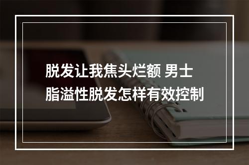 脱发让我焦头烂额 男士脂溢性脱发怎样有效控制