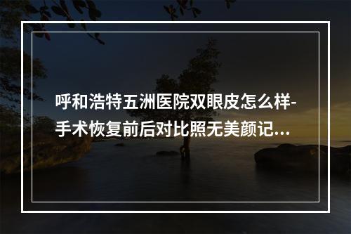 呼和浩特五洲医院双眼皮怎么样-手术恢复前后对比照无美颜记录