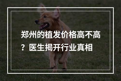 郑州的植发价格高不高？医生揭开行业真相