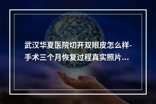 武汉华夏医院切开双眼皮怎么样-手术三个月恢复过程真实照片分享