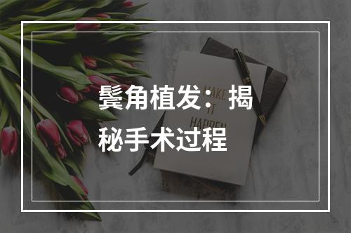 鬓角植发：揭秘手术过程