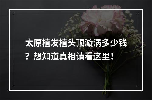 太原植发植头顶漩涡多少钱？想知道真相请看这里！