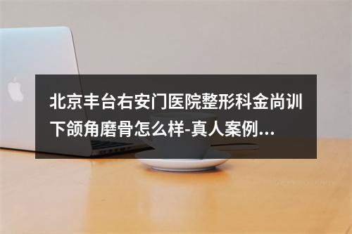 北京丰台右安门医院整形科金尚训下颌角磨骨怎么样-真人案例在线