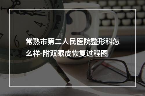 常熟市第二人民医院整形科怎么样-附双眼皮恢复过程图