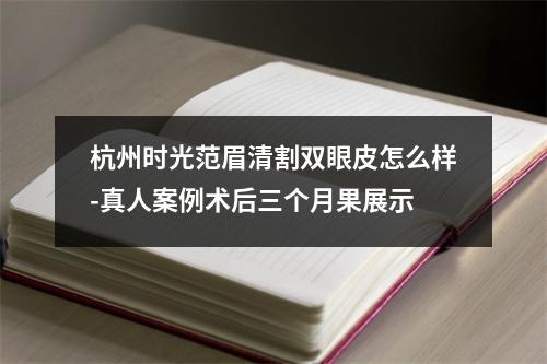 杭州时光范眉清割双眼皮怎么样-真人案例术后三个月果展示