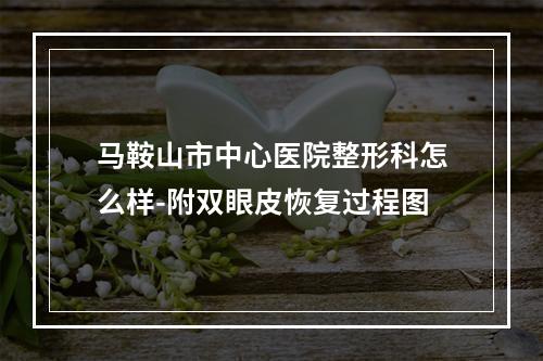 马鞍山市中心医院整形科怎么样-附双眼皮恢复过程图