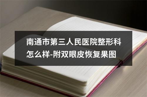 南通市第三人民医院整形科怎么样-附双眼皮恢复果图