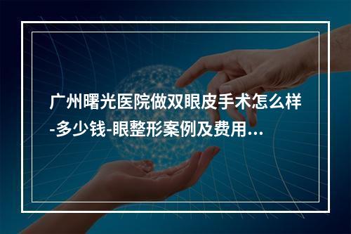 广州曙光医院做双眼皮手术怎么样-多少钱-眼整形案例及费用价格查询