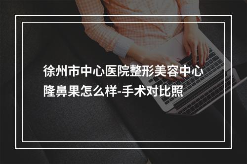 徐州市中心医院整形美容中心隆鼻果怎么样-手术对比照