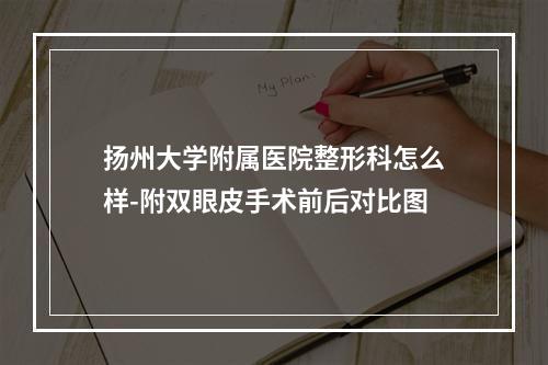 扬州大学附属医院整形科怎么样-附双眼皮手术前后对比图