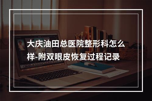 大庆油田总医院整形科怎么样-附双眼皮恢复过程记录