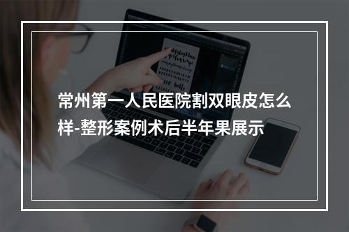 常州第一人民医院割双眼皮怎么样-整形案例术后半年果展示