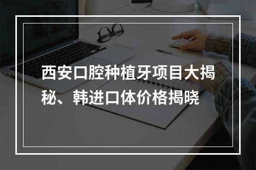 西安口腔种植牙项目大揭秘、韩进口体价格揭晓