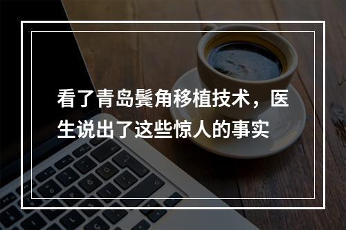 看了青岛鬓角移植技术，医生说出了这些惊人的事实