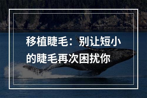 移植睫毛：别让短小的睫毛再次困扰你