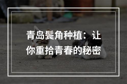 青岛鬓角种植：让你重拾青春的秘密