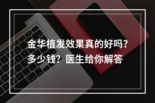 金华植发效果真的好吗？多少钱？医生给你解答