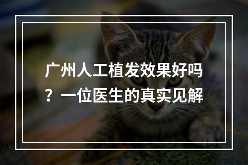 广州人工植发效果好吗？一位医生的真实见解