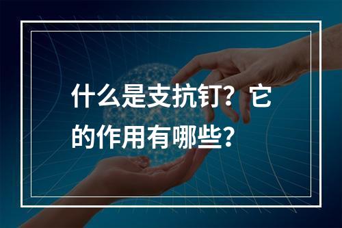 什么是支抗钉？它的作用有哪些？