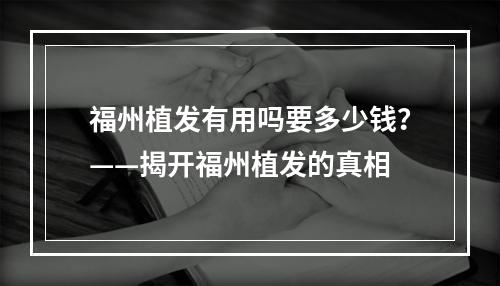 福州植发有用吗要多少钱？——揭开福州植发的真相