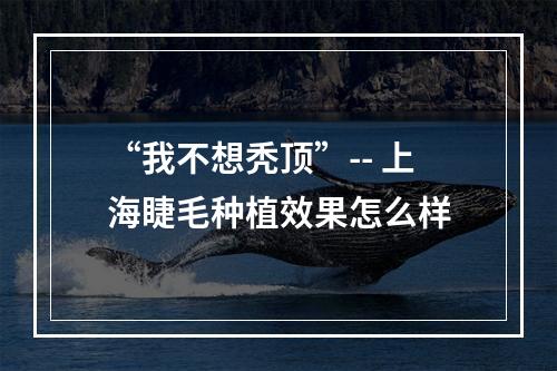 “我不想秃顶”-- 上海睫毛种植效果怎么样