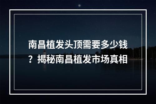 南昌植发头顶需要多少钱？揭秘南昌植发市场真相