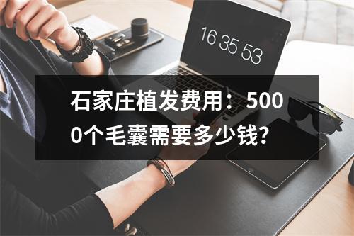 石家庄植发费用：5000个毛囊需要多少钱？