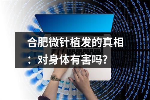 合肥微针植发的真相：对身体有害吗？