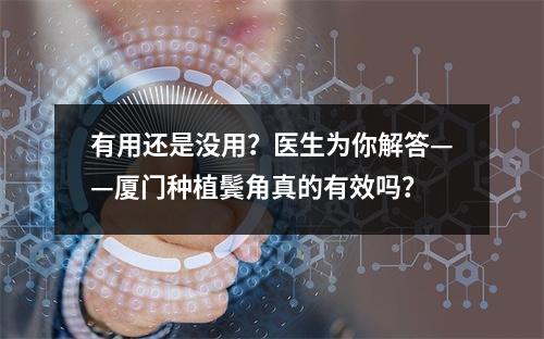 有用还是没用？医生为你解答——厦门种植鬓角真的有效吗？