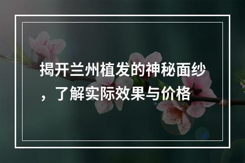 揭开兰州植发的神秘面纱，了解实际效果与价格