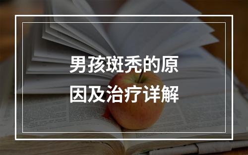 男孩斑秃的原因及治疗详解