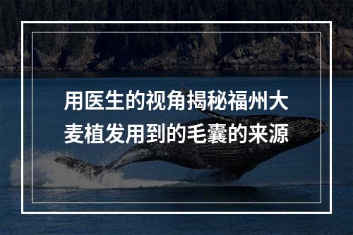 用医生的视角揭秘福州大麦植发用到的毛囊的来源